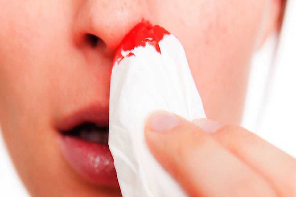 حاڵەتێکی نوێی تووشبوون بە تای خوێنبەربوون دەستنیشان کرا